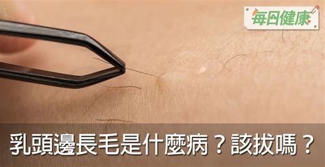 乳頭有毛|乳頭邊長了毛，是什麼病？該不該拔？讓名醫一次解釋給您聽｜每